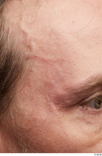 HD Face Skin Ryan Sutton face forehead skin pores skin…